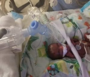 Premature Baby Only Weighed One Pound 100 Days Later Heads Home Happy And Healthy Premature Baby Only Weighed One Pound 100 Days Later Heads Home Happy And Healthy