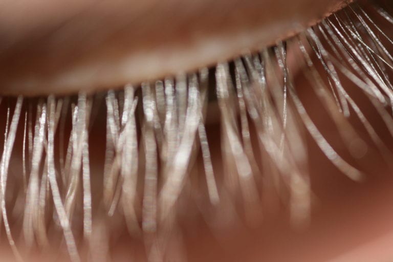 Lash lice more common in eyelash extensions some doctors are