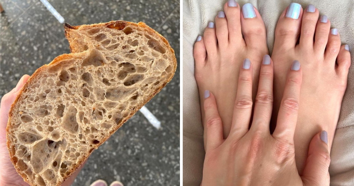 The quickest ways to get rid of calluses according dermatologists