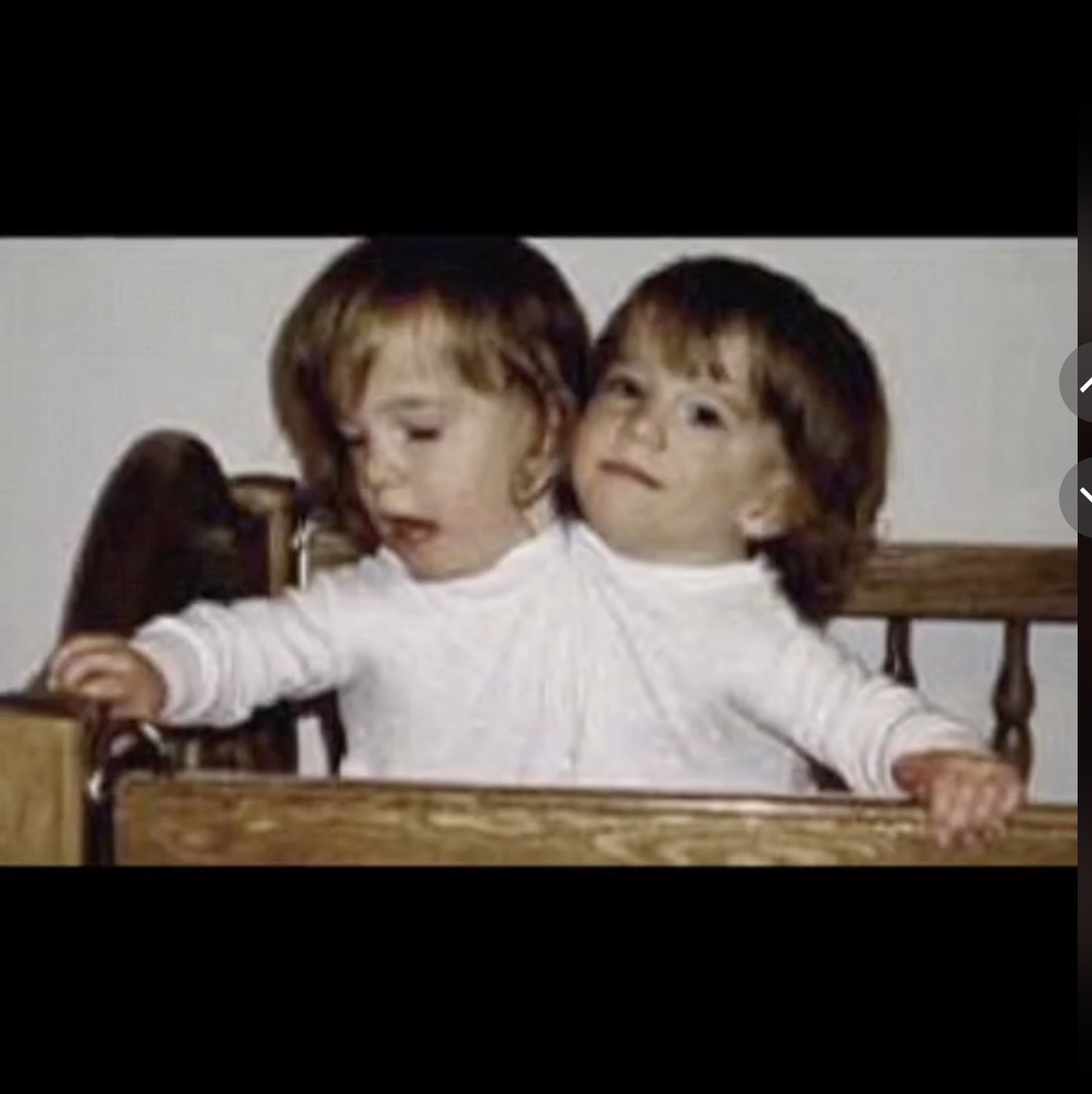 Conjoined twin sister Abby Hensel is now married and both hope to be ...