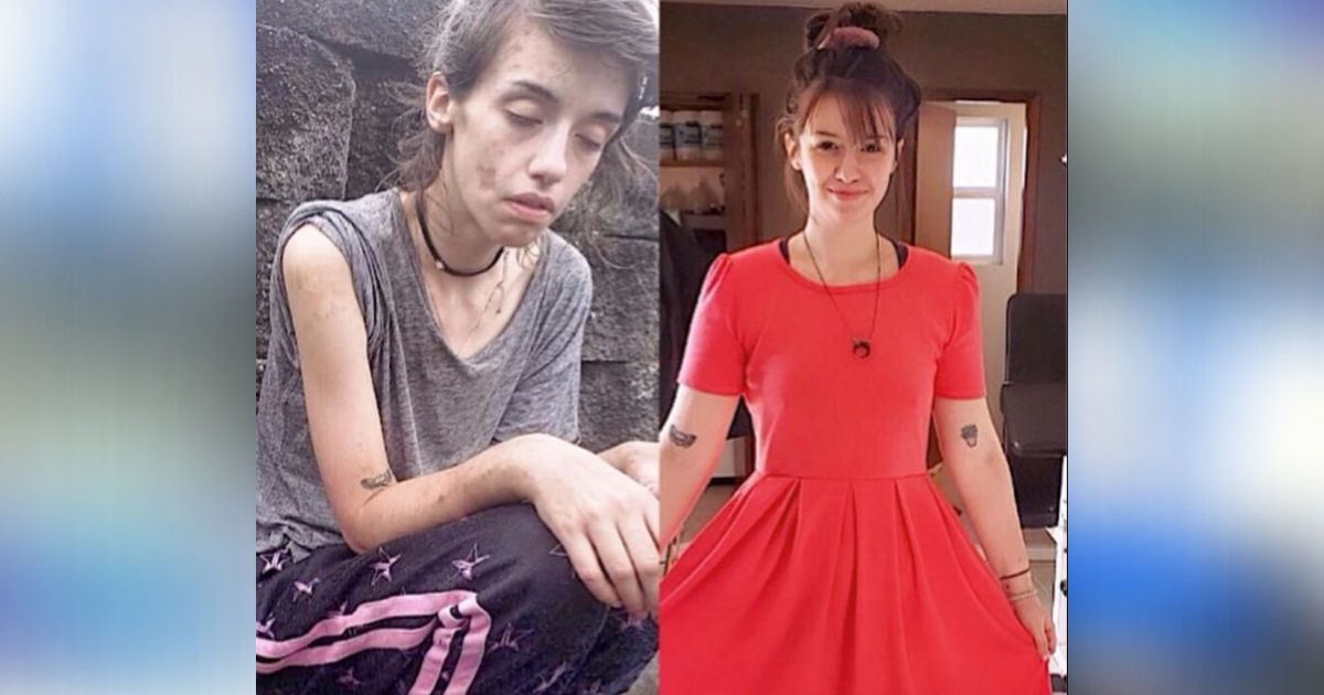 Person Addition 40 people who overcame their addiction and look like a completely ...